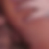 Anal